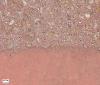 Granit rot 5-8/vb/3,5 +SB