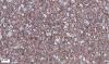 Waschbeton Neu1